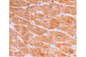 Immunohistochemical staining of human heart tissue using CASP1 polyclonal antibody  at 2 ug/mL .