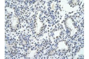 Rabbit Anti-ZNF264 antibody         Paraffin Embedded Tissue:  Human Lung    cell Cellular Data:  alveolar cell    Antibody Concentration:  4. (ZNF264 Antikörper  (C-Term))