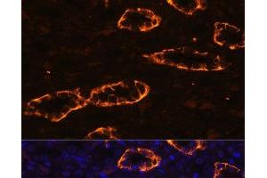 Immunofluorescence analysis of Rat kidney using AQP3 Polyclonal Antibody at dilution of 1:100. (AQP3 Antikörper)