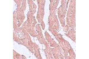Immunohistochemical staining of mouse heart tissue with LZTR1 polyclonal antibody  at 5 ug/mL dilution. (LZTR1 Antikörper  (N-Term))