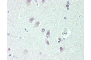 Human Brain, Cortex: Formalin-Fixed, Paraffin-Embedded (FFPE) (NOVA1 Antikörper  (C-Term))