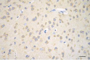 Immunohistochemistry was performed on paraffin-embedded mouse brain using huntingtin antibody (ABIN7799005), 1:200). (Rekombinanter Huntingtin Antikörper)