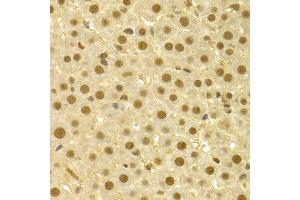 Immunohistochemistry of paraffin-embedded rat liver using CDC25A antibody (ABIN5970519) at dilution of 1/100 (40x lens). (CDC25A Antikörper)