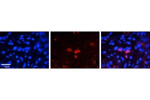 Rabbit Anti-CLN6 Antibody     Formalin Fixed Paraffin Embedded Tissue: Human Pineal Tissue  Observed Staining: Cytoplasmic in cell bodies of pinealocytes  Primary Antibody Concentration: 1:100  Other Working Concentrations: 1/600  Secondary Antibody: Donkey anti-Rabbit-Cy3  Secondary Antibody Concentration: 1:200  Magnification: 20X  Exposure Time: 0. (CLN6 Antikörper  (C-Term))