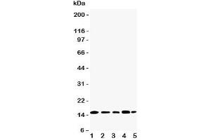 Western blot testing of TIA-1 antibody and Lane 1:  Jurkat;  2: Raji;  3: CEM;  4: HT1080;  5: K562 cell lysate. (TIA1 Antikörper  (N-Term))