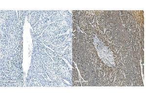 IHC analysis of OB Cadherin/CDH11 using anti-OB Cadherin/CDH11 antibody (ABIN5518978).