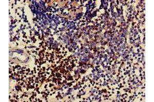 Immunohistochemistry of paraffin-embedded human spleen tissue using ABIN7171382 at dilution of 1:100 (CD3 epsilon Antikörper  (AA 23-126))