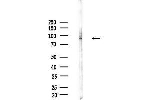anti-Zinc Finger, FYVE Domain Containing 20 (ZFYVE20) (Internal Region) antibody