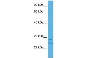 Host:  Rabbit  Target Name:  CSRP3  Sample Tissue:  Human HCT116 Whole Cell  Antibody Dilution:  1ug/ml (CSRP3 Antikörper  (Middle Region))