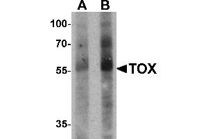 Western blot analysis of TOX in human colon tissue lysate with TOX antibody at (A) 1 and (B) 2 µg/mL.