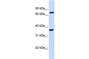 Western Blotting (WB) image for anti-Chemokine (C-C Motif) Receptor-Like 2 (CCRL2) antibody (ABIN2458062) (CCRL2 Antikörper)