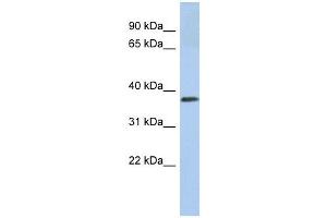 Calreticulin 3 antibody used at 1 ug/ml to detect target protein.