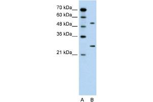 WB Suggested Anti-CACNB1 Antibody Titration:  0. (CACNB1 Antikörper  (Middle Region))