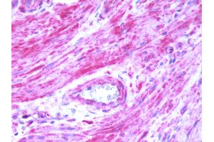 Human Prostate: Formalin-Fixed, Paraffin-Embedded (FFPE) (BDKRB2 Antikörper  (C-Term))