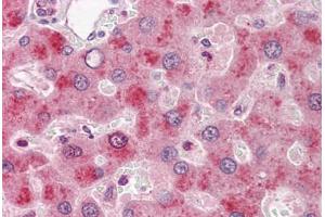 Human Liver: Formalin-Fixed, Paraffin-Embedded (FFPE) (Coagulation Factor IX Antikörper)