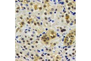Immunohistochemical analysis of Rent2 staining in rat kidney formalin fixed paraffin embedded tissue section.