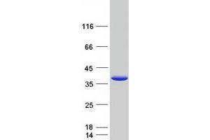 Western Blotting (WB) image for Heterogeneous Nuclear Ribonucleoprotein A1 (HNRNPA1) (Transcript Variant 2) protein (Myc-DYKDDDDK Tag) (ABIN2722905)