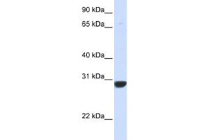 WB Suggested Anti-PNPO Antibody Titration: 0.