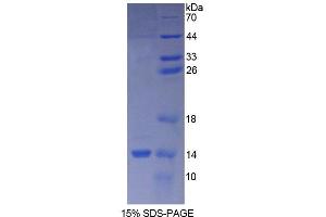 Image no. 1 for Chorionic Gonadotropin, beta Polypeptide 1 (CGB1) (AA 55-153) protein (His tag) (ABIN6239993)