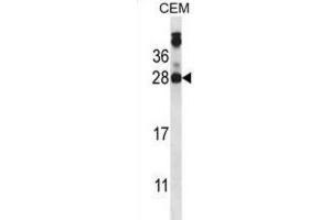 Western Blotting (WB) image for anti-Junctional Adhesion Molecule 2 (JAM2) antibody (ABIN2997813) (JAM2 Antikörper)