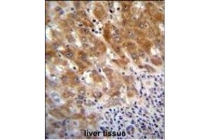 FAH Antibody (N-term) (ABIN655906 and ABIN2845306) immunohistochemistry analysis in formalin fixed and paraffin embedded human liver tissue followed by peroxidase conjugation of the secondary antibody and DAB staining.