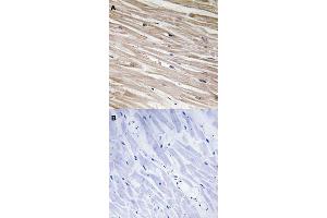 Immunohistochemical staining (Formalin-fixed paraffin-embedded sections) of human heart tissue with PEA15 (phospho S104) polyclonal antibody  without blocking peptide (A) or preincubated with blocking peptide (B) under 1:50-1:100 dilution. (PEA15 Antikörper  (pSer104))