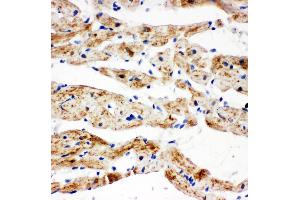 Anti-SDHB antibody, IHC(P) IHC(P): Rat Cardiac Muscle Tissue (SDHB Antikörper  (N-Term))