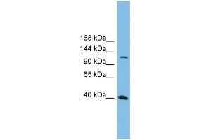 WB Suggested Anti-MAP3K14  Antibody Titration: 0.