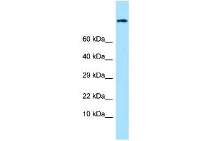 WB Suggested Anti-EMR1 Antibody Titration: 1. (F4/80 Antikörper  (C-Term))