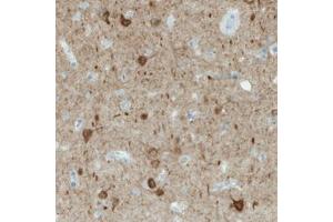 Immunohistochemical staining (Formalin-fixed paraffin-embedded sections) of human cerebral cortex with NECAB1 monoclonal antibody, clone CL0580  shows immunoreactivity in a subset of neuronal cells.