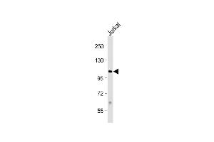 Anti-PRMT10 Antibody (N-term) at 1:1000 dilution + Jurkat whole cell lysate Lysates/proteins at 20 μg per lane. (PRMT10 Antikörper  (N-Term))