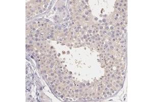 Immunohistochemical staining of human testis with KIAA1333 polyclonal antibody  shows weak cytoplasmic positivity in cells in seminiferus ducts at 1:200-1:500 dilution. (G2E3 Antikörper)