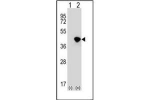 Western blot analysis of DFFA (arrow) using DFFA / ICAD Antibody (C-term) Cat. (DFFA Antikörper  (C-Term))