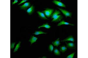 Immunofluorescence staining of Hela cells with ABIN7143995 at 1:66, counter-stained with DAPI. (AIMP1 Antikörper  (AA 25-180))