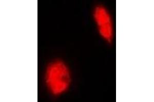 Immunofluorescent analysis of ERG staining in Hela cells. (ERG Antikörper)