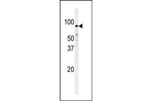 Image no. 1 for anti-phosphofructokinase, Muscle (PFKM) (C-Term) antibody (ABIN360633) (PFKM Antikörper  (C-Term))