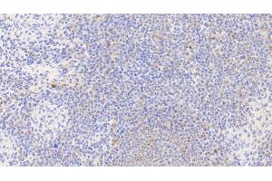 Immunohistochemistry (IHC) image for anti-Heat Shock 60kDa Protein 1 (Chaperonin) (HSPD1) (AA 1-573) antibody (ABIN7432685)