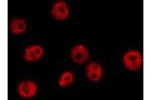 ABIN6278396 staining  Hela cells by IF/ICC. (RASSF2 Antikörper  (Internal Region))