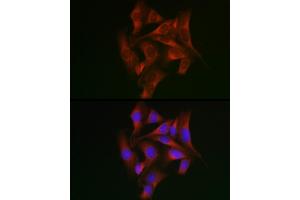 Immunofluorescence analysis of U2OS cells using STA Rabbit pAb (ABIN6128540, ABIN6148576, ABIN6148578 and ABIN6223670) at dilution of 1:50 (40x lens). (STAT5A Antikörper  (AA 635-794))