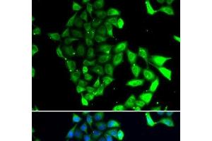Immunofluorescence analysis of MCF-7 cells using MID1 Polyclonal Antibody (MID1 Antikörper)