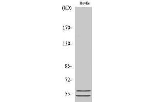 Western Blotting (WB) image for anti-serpin Peptidase Inhibitor, Clade A (Alpha-1 Antiproteinase, Antitrypsin), Member 6 (SERPINA6) (Internal Region) antibody (ABIN3183700) (SERPINA6 Antikörper  (Internal Region))