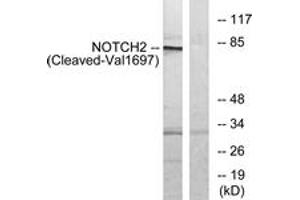 Western blot analysis of extracts from Jurkat cells, treated with etoposide 25uM 24h, using NOTCH2 (Cleaved-Val1697) Antibody. (NOTCH2 Antikörper  (Cleaved-Val1697))