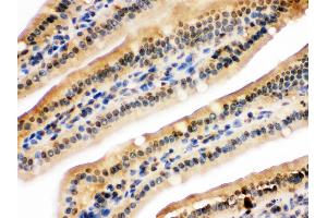 Immunohistochemistry (Paraffin-embedded Sections) (IHC (p)) image for anti-Ubiquitin-Like with PHD and Ring Finger Domains 2, E3 Ubiquitin Protein Ligase (UHRF2) (AA 15-54), (N-Term) antibody (ABIN3044559)