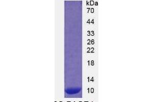 SDS-PAGE (SDS) image for S100 Calcium Binding Protein A12 (S100A12) ELISA Kit (ABIN6574251)