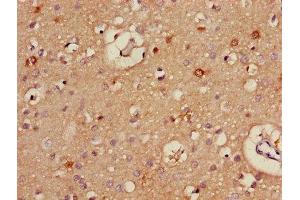 Immunohistochemistry of paraffin-embedded human brain tissue using ABIN7170921 at dilution of 1:100 (ALDH5A1 Antikörper  (AA 48-535))