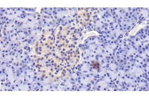Detection of PIIINP in Human Pancreas Tissue using Polyclonal Antibody to Procollagen III N-Terminal Propeptide (PIIINP) (PIIINP Antikörper)