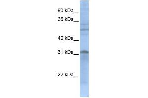 WB Suggested Anti-MTCH2 Antibody Titration: 0. (MTCH2 Antikörper  (N-Term))