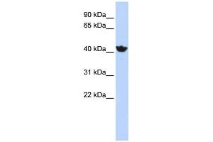 ADH4 antibody used at 1 ug/ml to detect target protein. (ADH4 Antikörper)