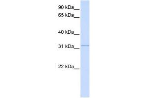 SUSD4 antibody used at 1 ug/ml to detect target protein. (SUSD4 Antikörper  (N-Term))
