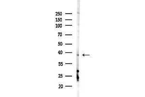 anti-TWIST Neighbor (TWISTNB) (C-Term) antibody